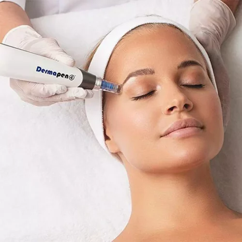 dermapen-2
